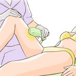 脱毛技術の最新事情